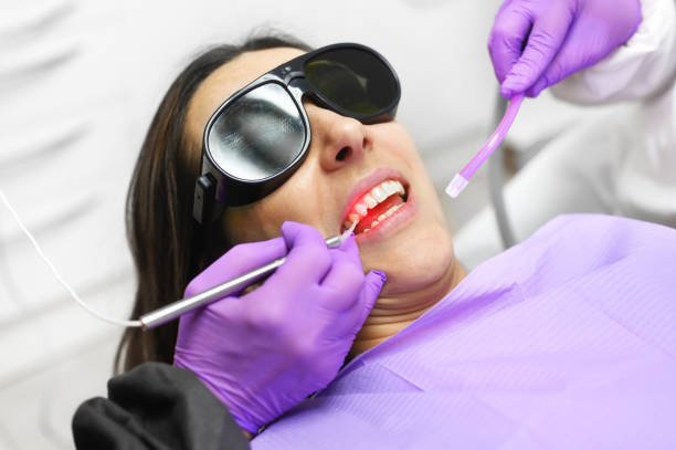 laser assisted flap surgery at fort dental tolichowki
